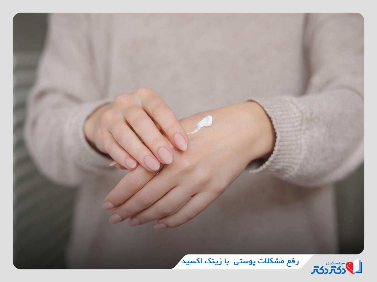 رفع راش پوستی با زینک اکساید