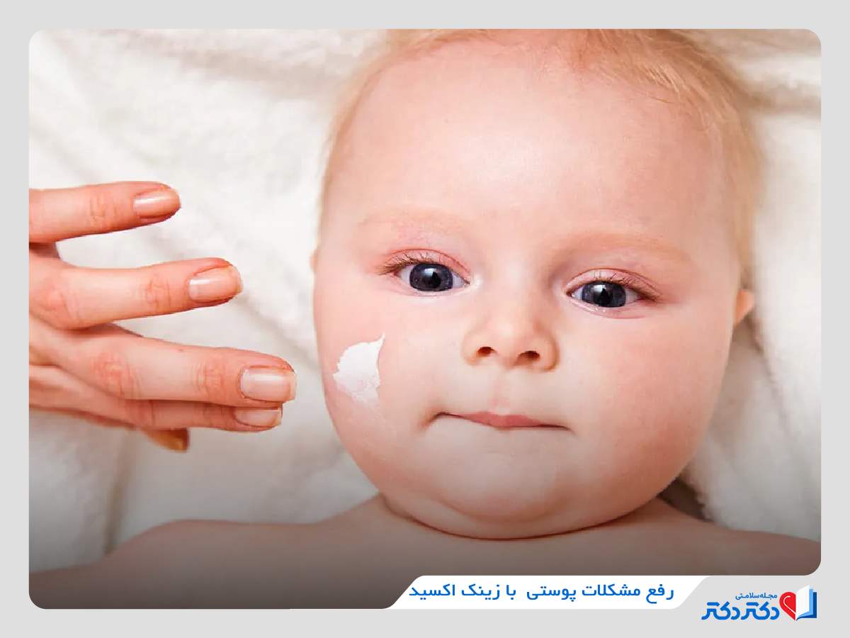زینک اکساید برای کودکان