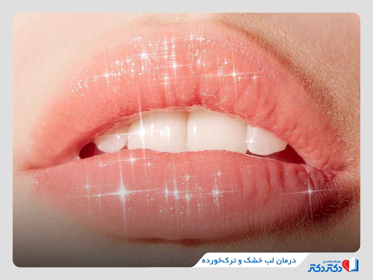 درمان لب ترک خورده