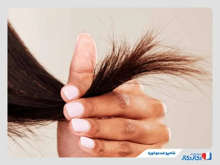 مصرف شامپو ضد موخوره برای درمان موخوره