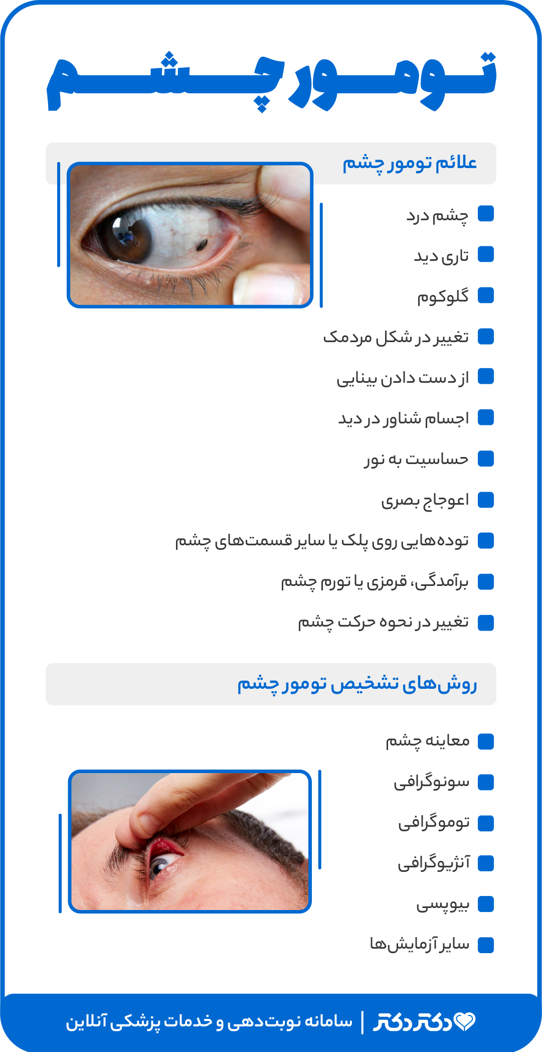 اینفوگرافی تومور چشم