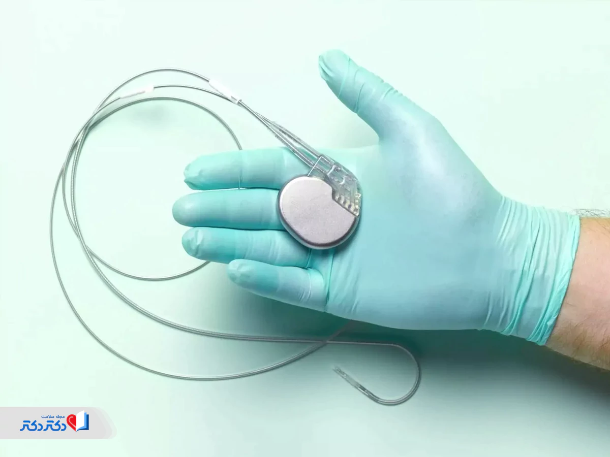 ICD برای درمان آریتمی قلب