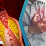نشانه ها و علائم گرفتگی عروق (تایید شده توسط دکتر قلب)