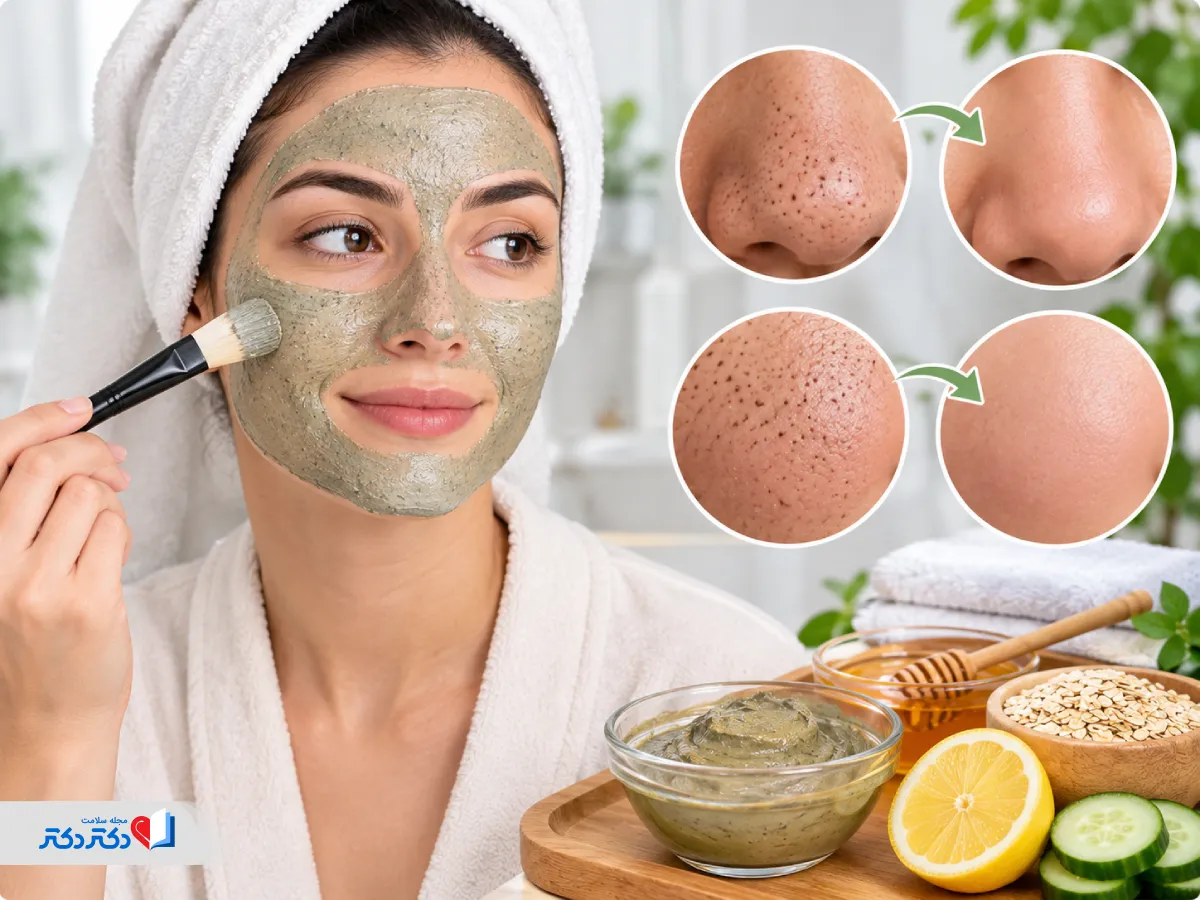 ماسک برای جوش سر سیاه