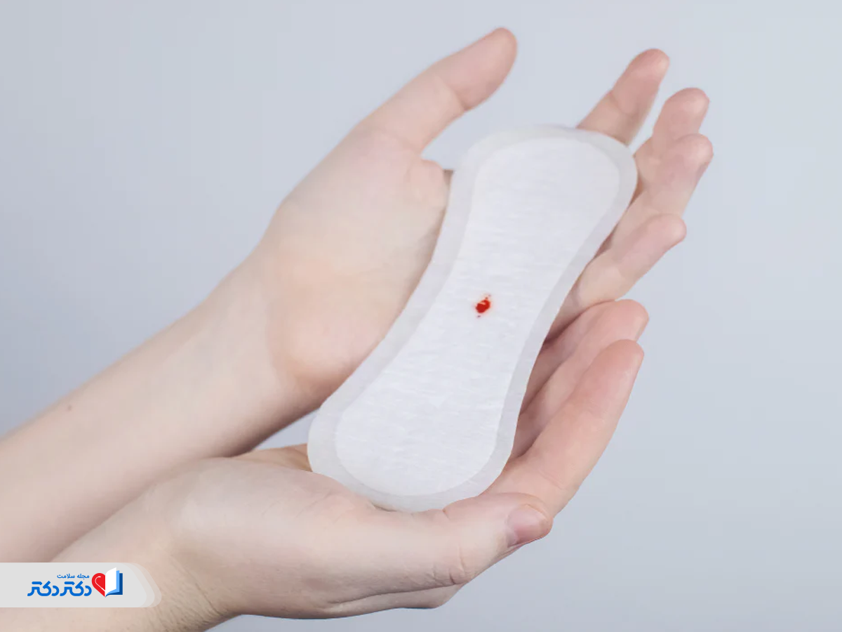 لکهبینی میاندورهای از شایعترین عوارض قرص ضد بارداری