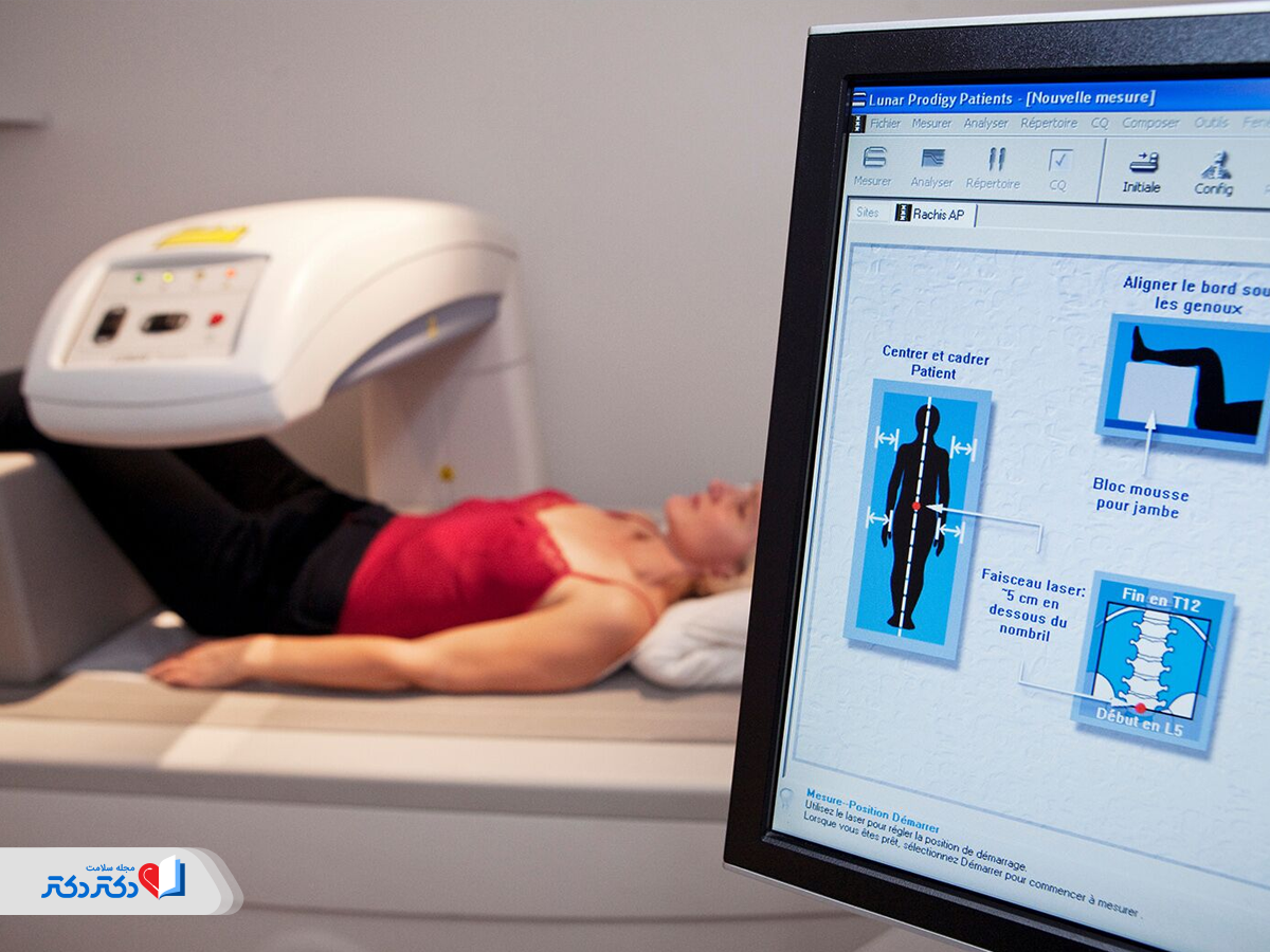 تست تراکم استخوان در آزمایش چکاپ زنان