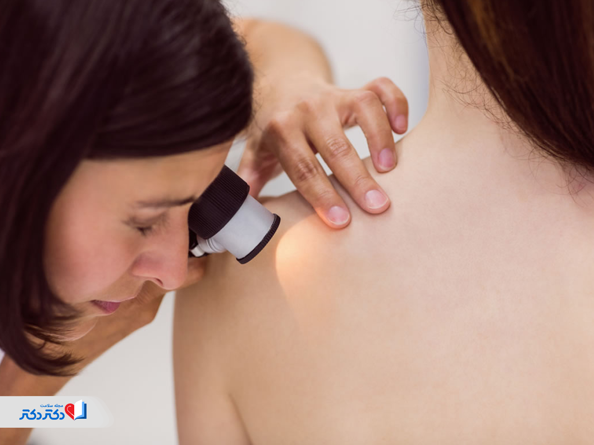 آزمایش معاینه پوست