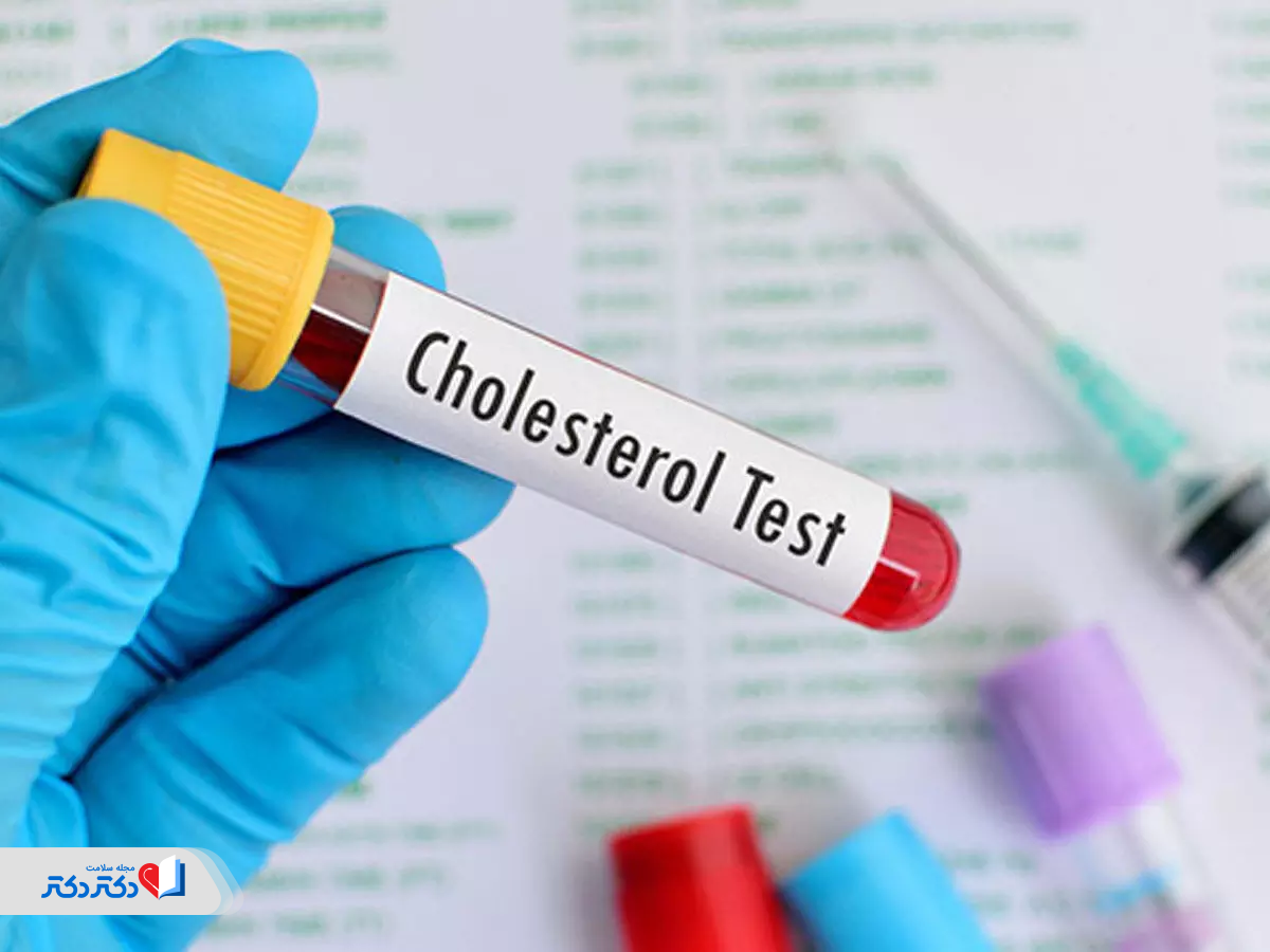 تست کلسترول در آزمایش چکاپ زنان