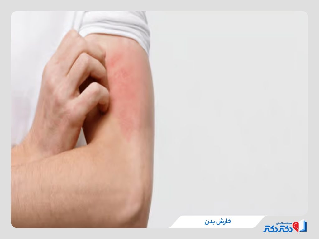 علت و درمان خارش بدن