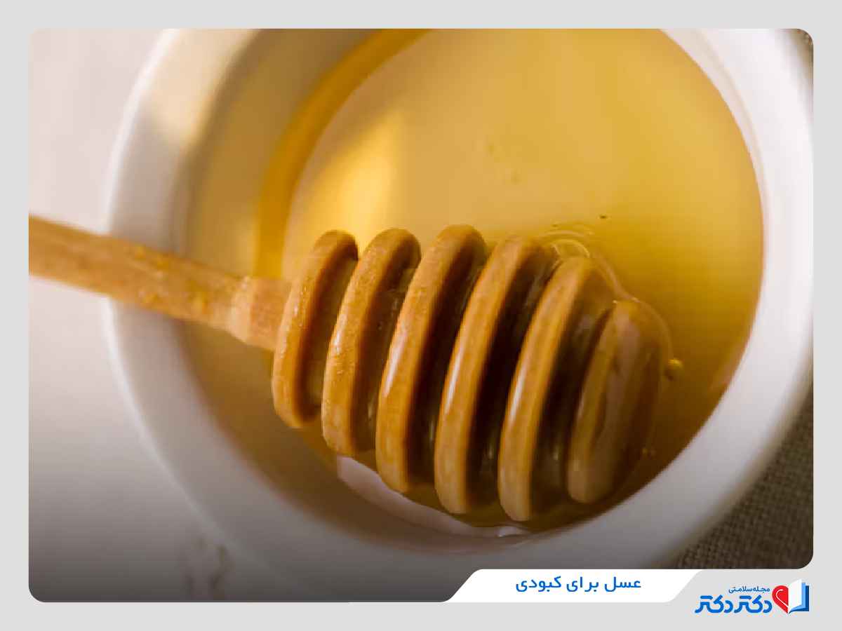 عسل برای کبودی