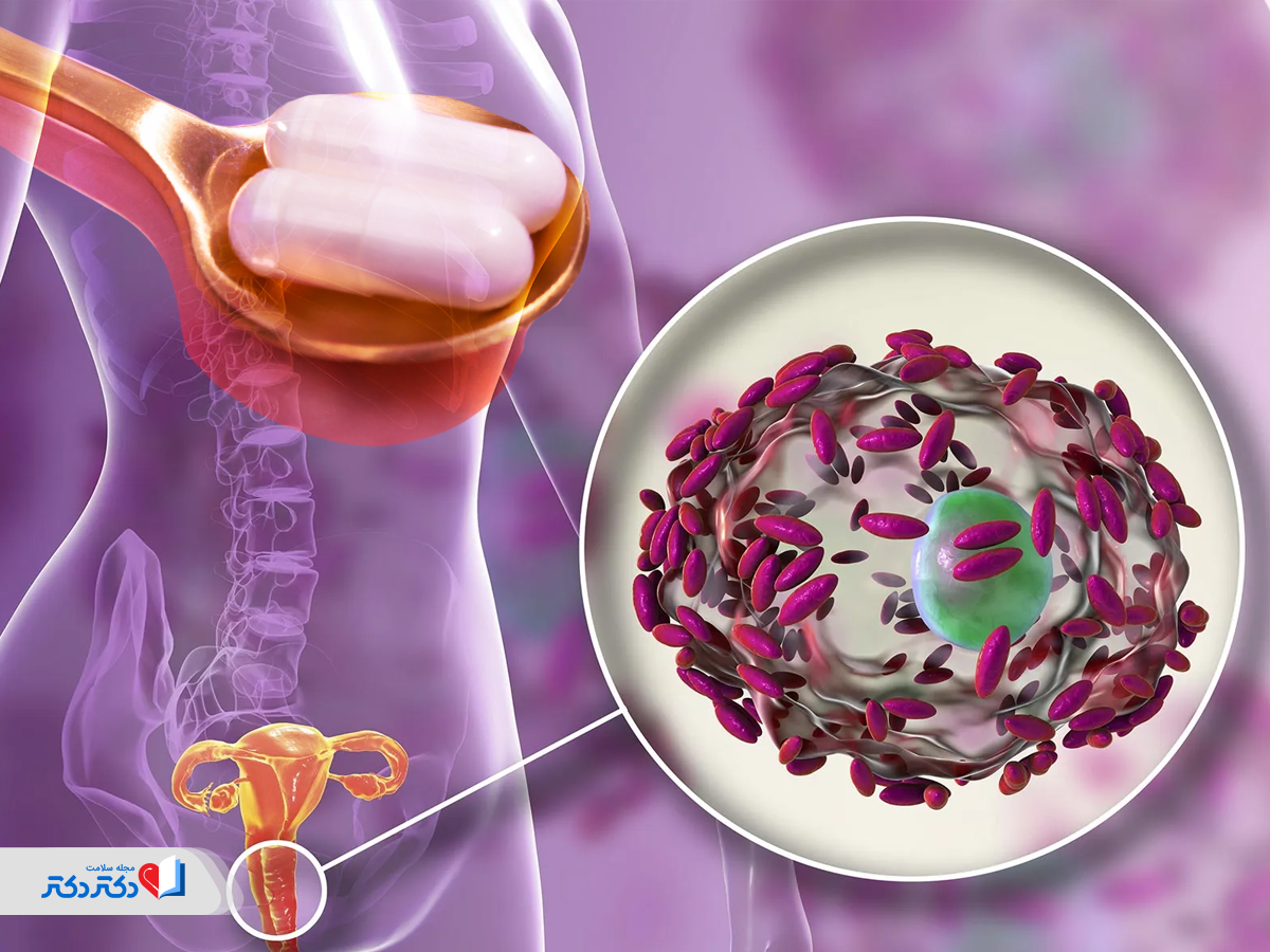 تأثیر دارو بر عفونت واژن