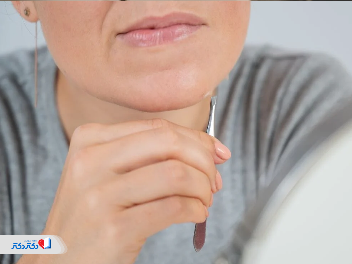 رویش موی زائد از عوارض یائسگی