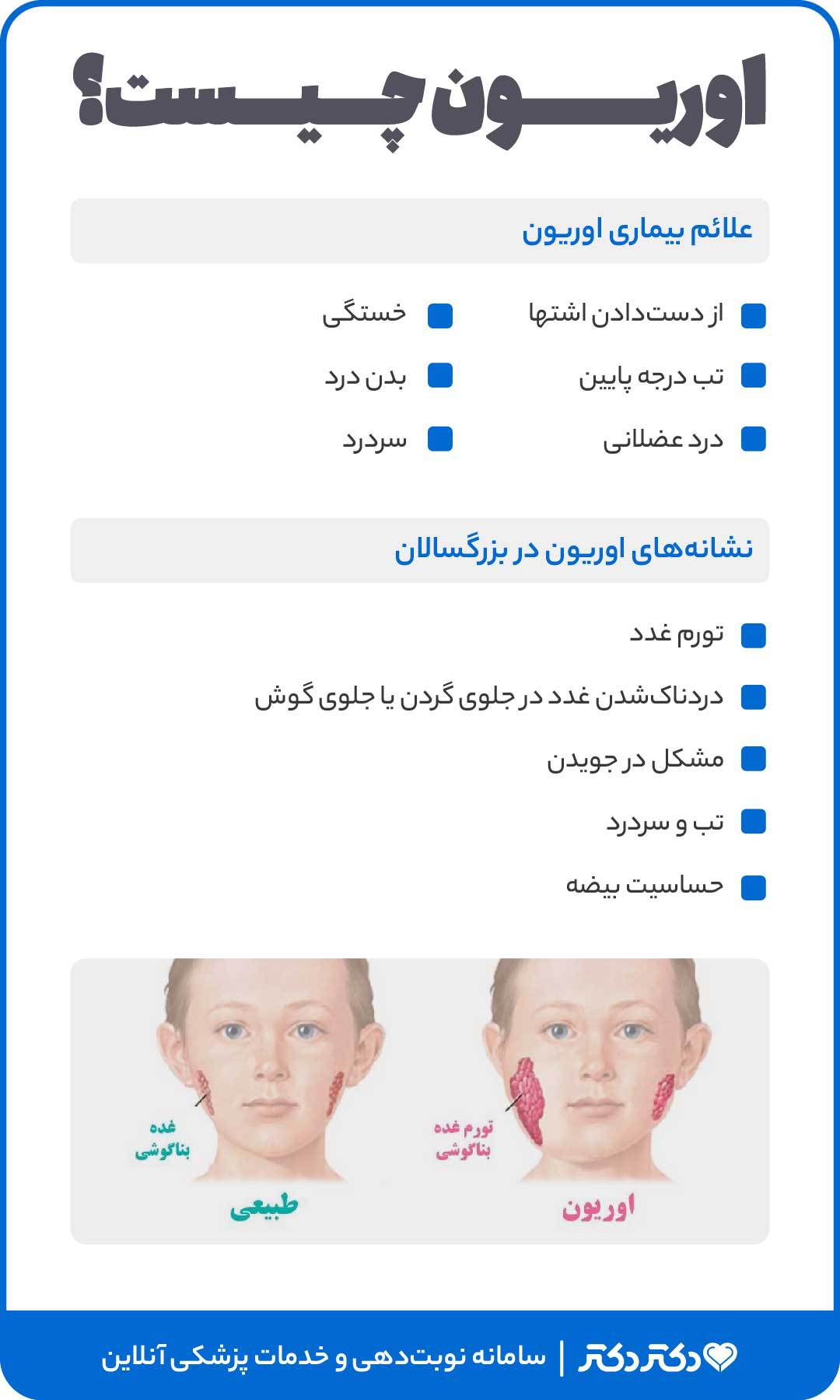 اینفوگرافی اوریون