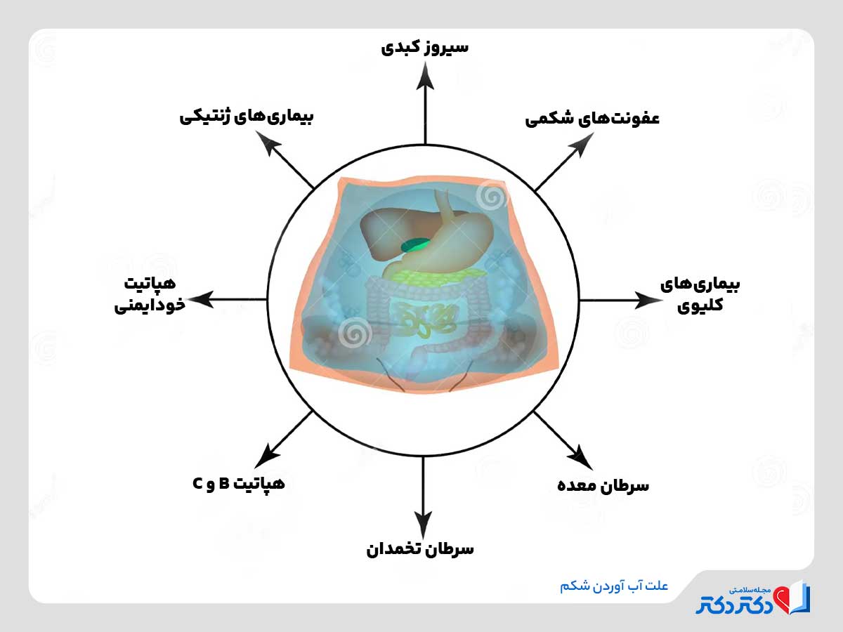 دلایل آب آوردن شکم 