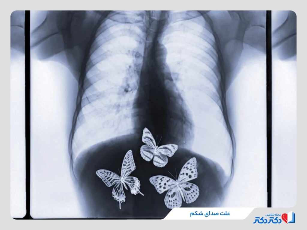 علت صدای شکم
