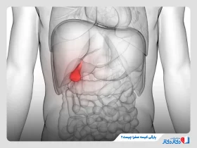 پارگی کیسه صفرا چه علائمی دارد؟ + راهکارهای مهم اورژانسی