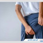 فیستول مقعدی چیست و در اثر چه عواملی ایجاد می‌شود؟ (تایید شده توسط پزشک)