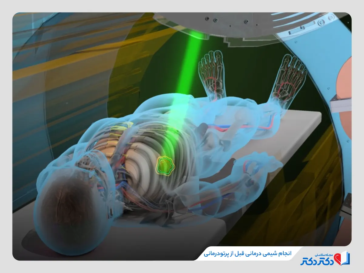 مراحل انجام شیمی درمانی و پرتو درمانی