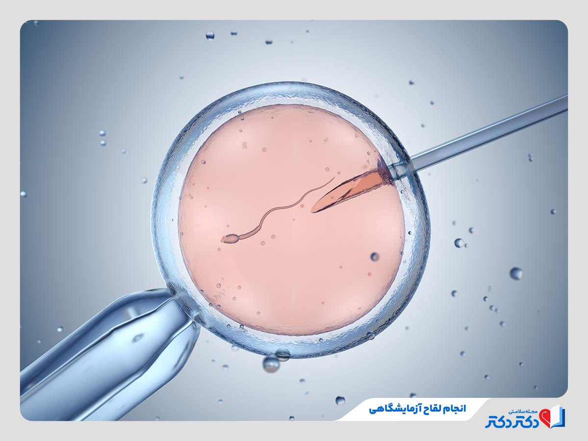 انجام لقاح تخمک و اسپرم در آزمایشگاه برای انتقال به رحم اجاره ای