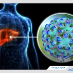 هپاتیت دی چیست و چطور منتقل می‌شود؟