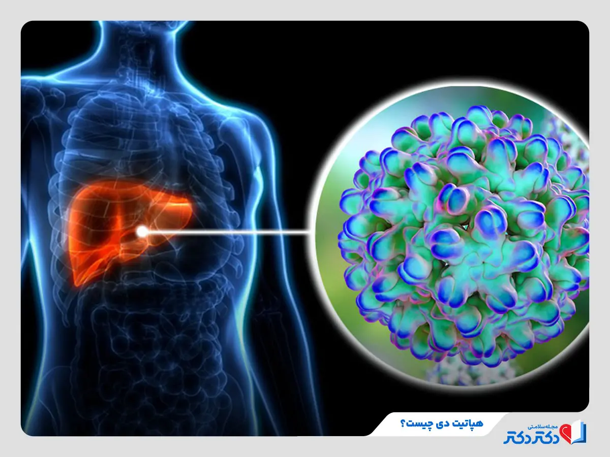 علت ابتلا به بیماری هپاتیت دی و علائم آن