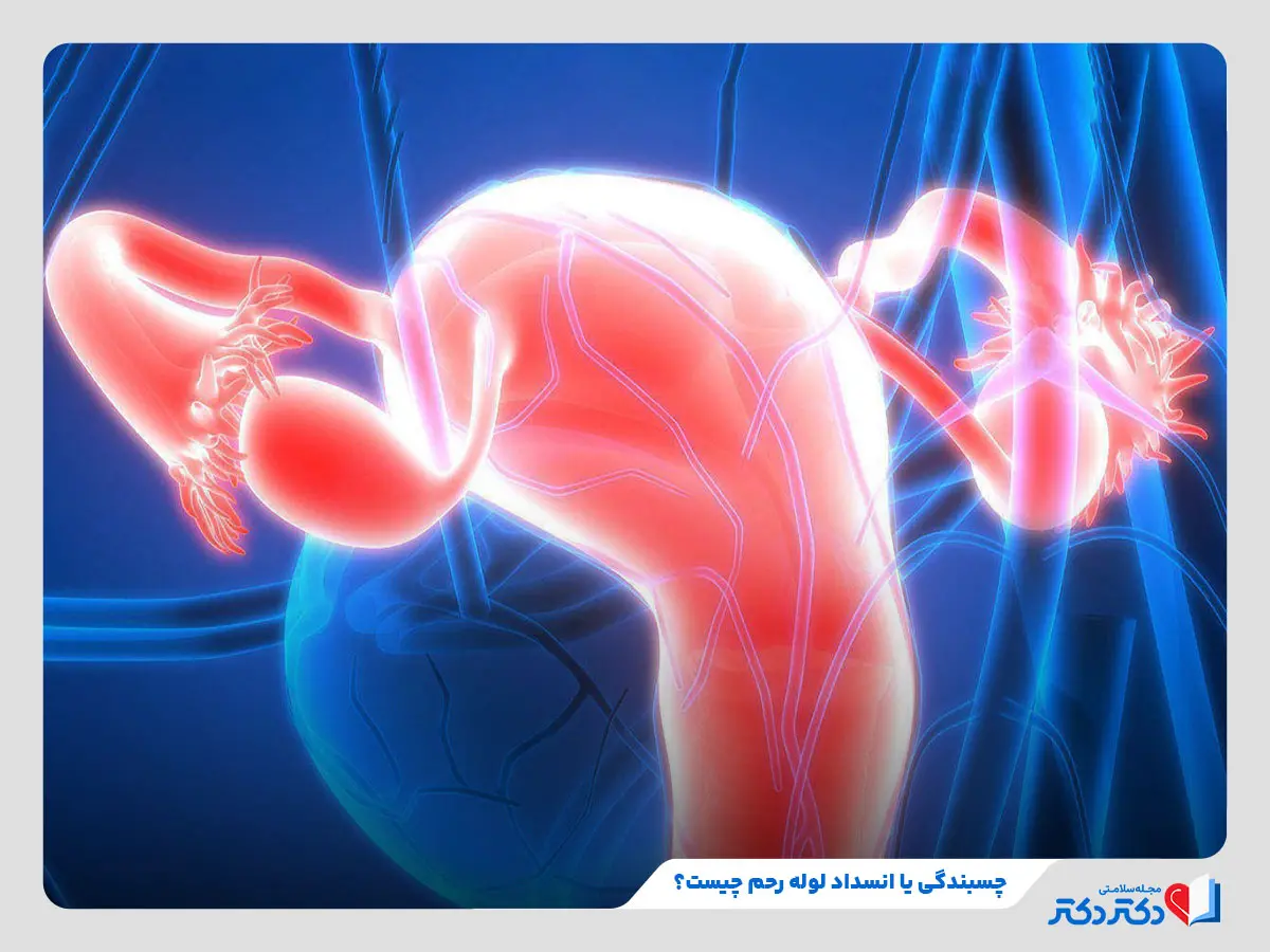 بررسی بیماری انسداد لوله‌های رحم و عوارض و دلایل آن