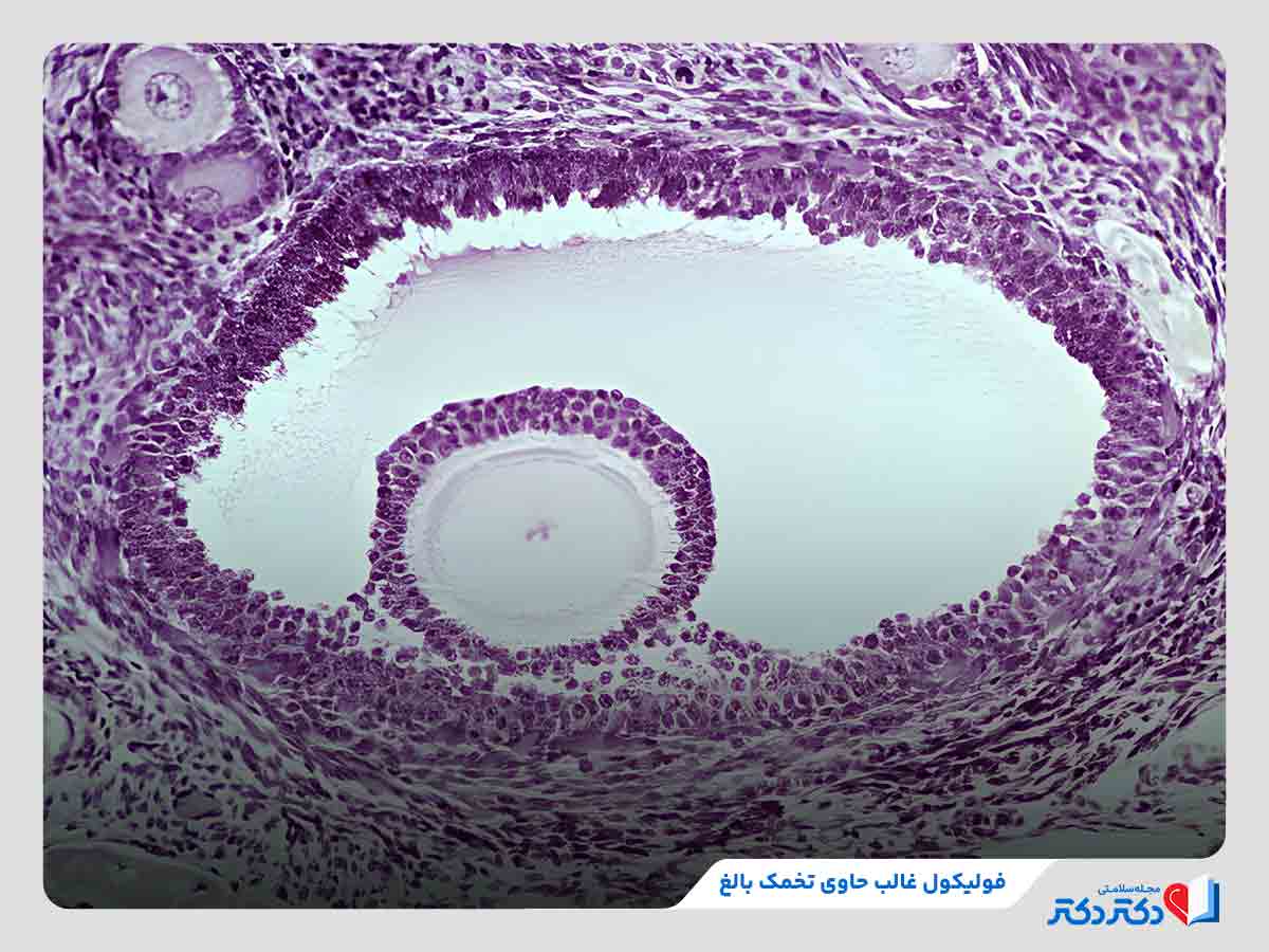 تخمکل بالغ در حال رشد در داخل فولیکول غالب