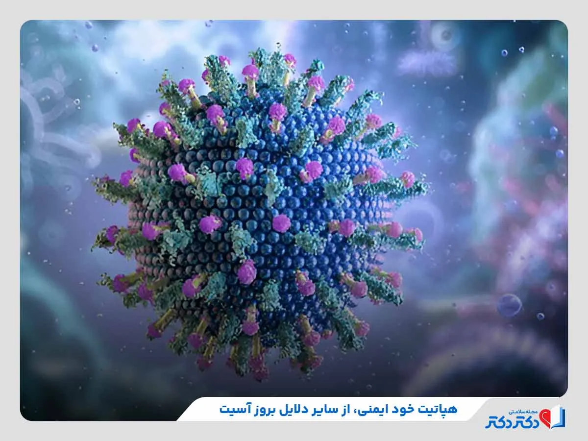 آب آوردن شکم به دلیل ابتلا به هپاتیت