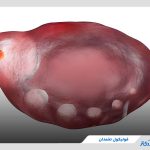 فولیکول تخمدان چیست و چه وظایفی بر عهده دارد؟