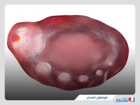 فولیکول تخمدان چیست و چه وظایفی بر عهده دارد؟