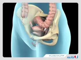 افتادگی رحم چیست؟ + علائم، علل و درمان پرولاپس رحم