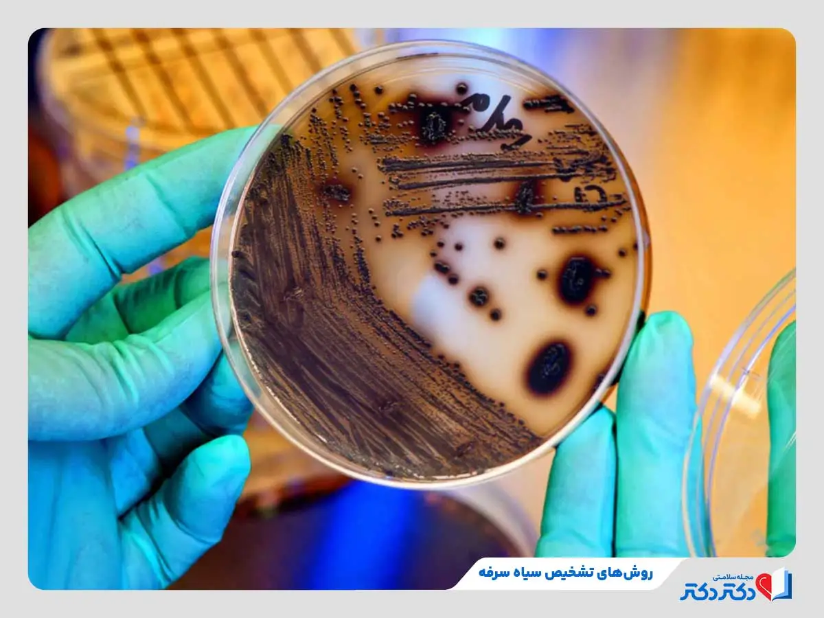 تست PCR برای تشخیص نوع باکتری عامل ایجاد سیاه سرفه