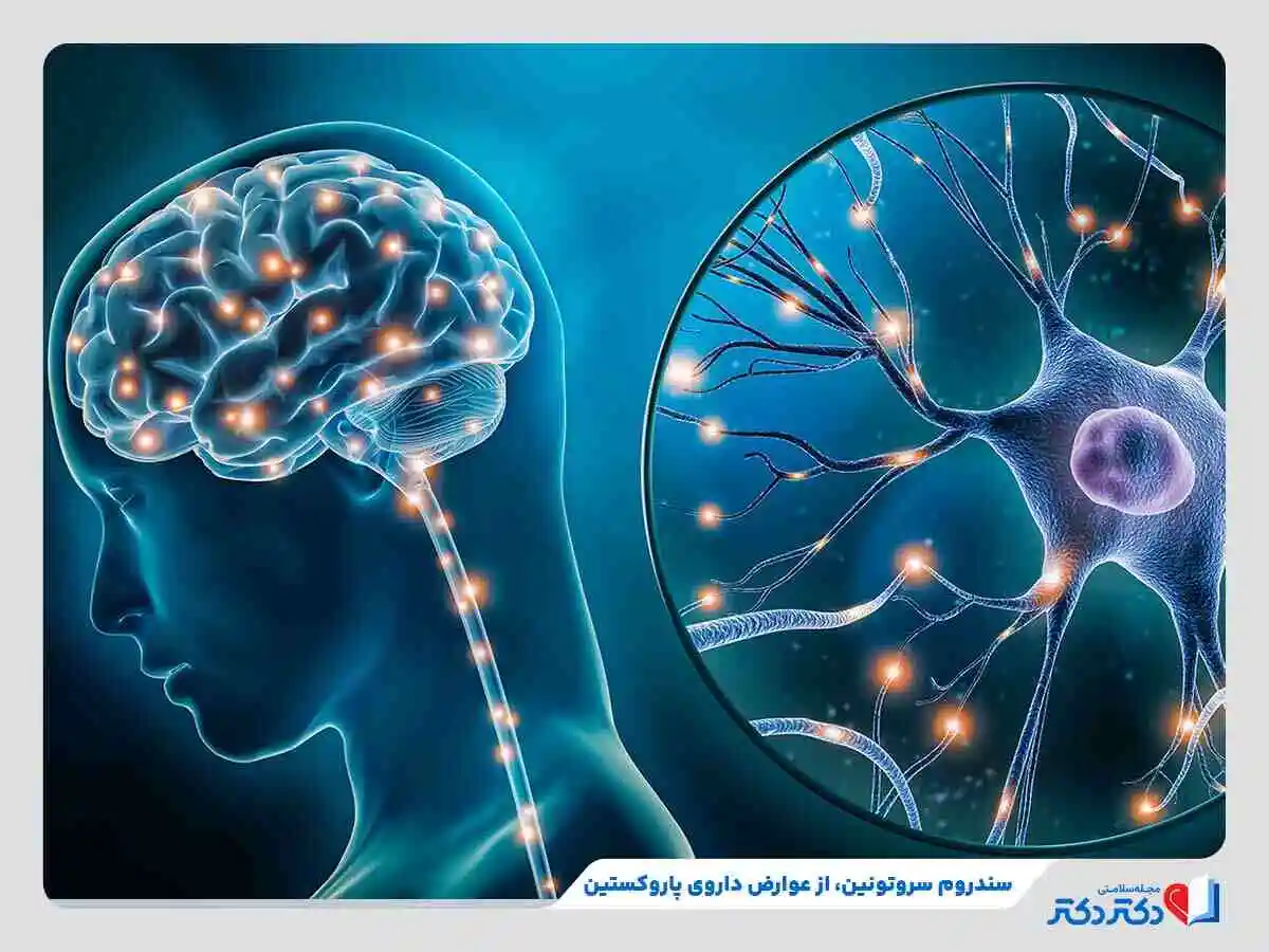 سندروم سروتونین در اثر مصرف پاروکستین با دیگر داروهای افزایش‌دهنده این سروتونین