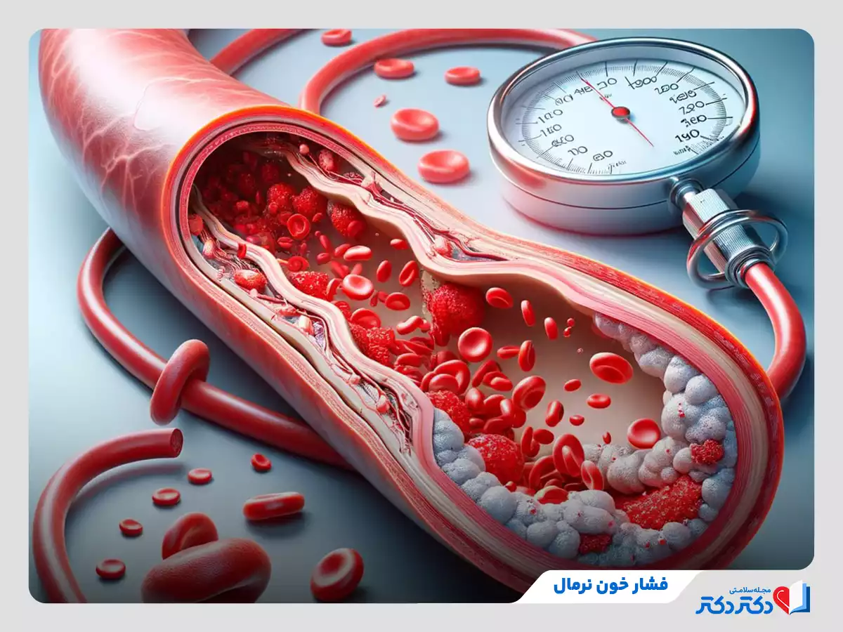 بررسی فشار خون نرمال و نحوه اندازه گیری آن