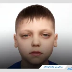 آیا سیاهی زیر چشم کودکان خطرناک است؟ بررسی دلایل و روش‌های درمانی