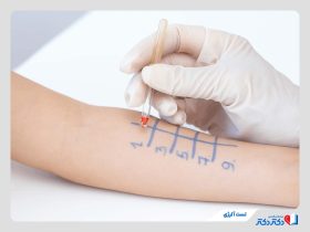 تست آلرژی چیست و در چه شرایطی باید انجام شود؟