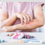 داروهای ضد حساسیت؛ 12 نوع دارویی + بررسی مکانیسم عملکرد