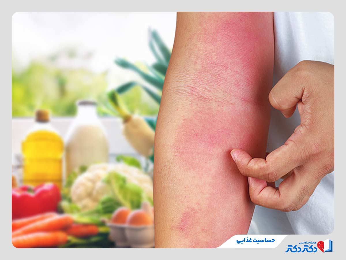 فرد مبتلا به حساسیت غذایی