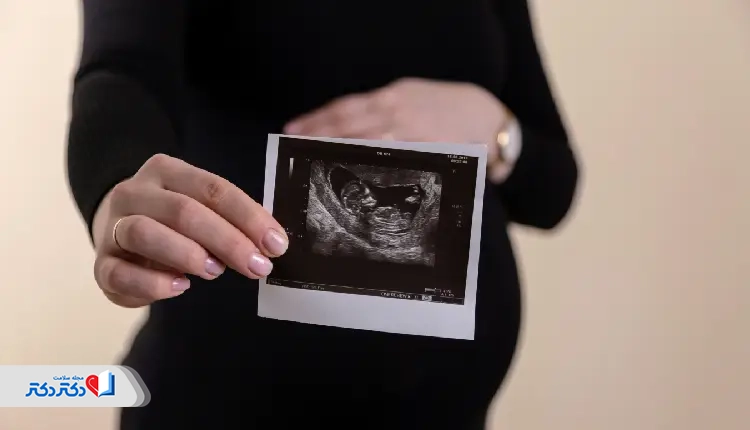 A pregnant woman holding an ultrasound image, highlighting the importance of prenatal screenings such as the MCH test during pregnancy