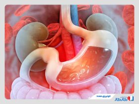 خونریزی معده چیست و چگونه درمان می‌شود؟ + روش‌های درمان و پیشگیری از آن