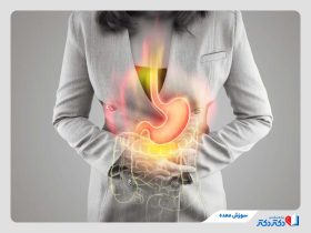 سوزش معده چیست و چرا به آن مبتلا می‌شویم؟ + روش‌های پیشگیری و درمان