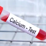 آزمایش Ca (کلسیم): تفسیر نتایج، علت انجام و نکات مهم