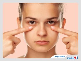 سیاهی دور چشم چیست و چطور درمان می‌شود؟