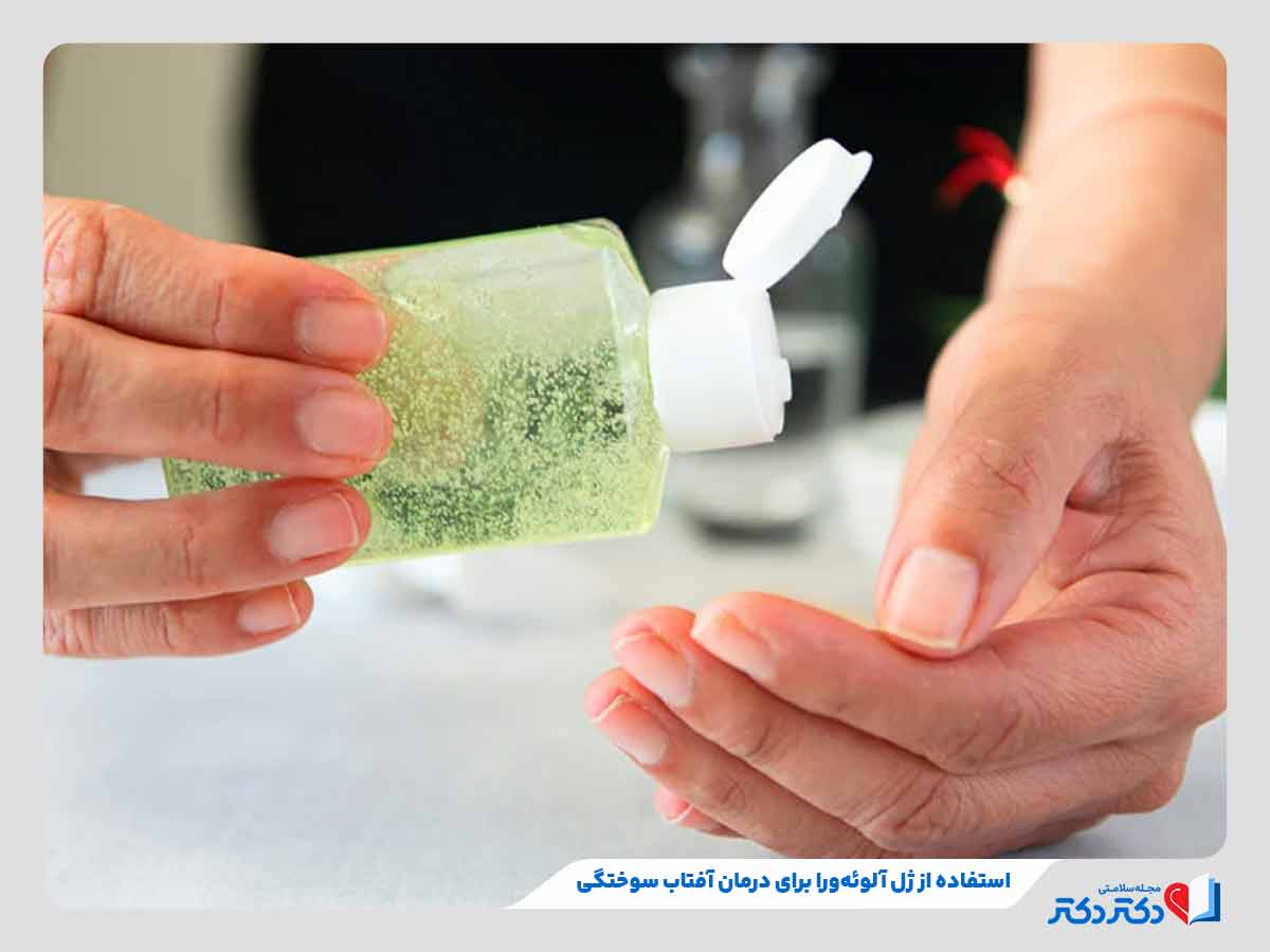 فرد در حال استفاده از ژل آلوئه ورا برای درمان آفتاب سوختگی
