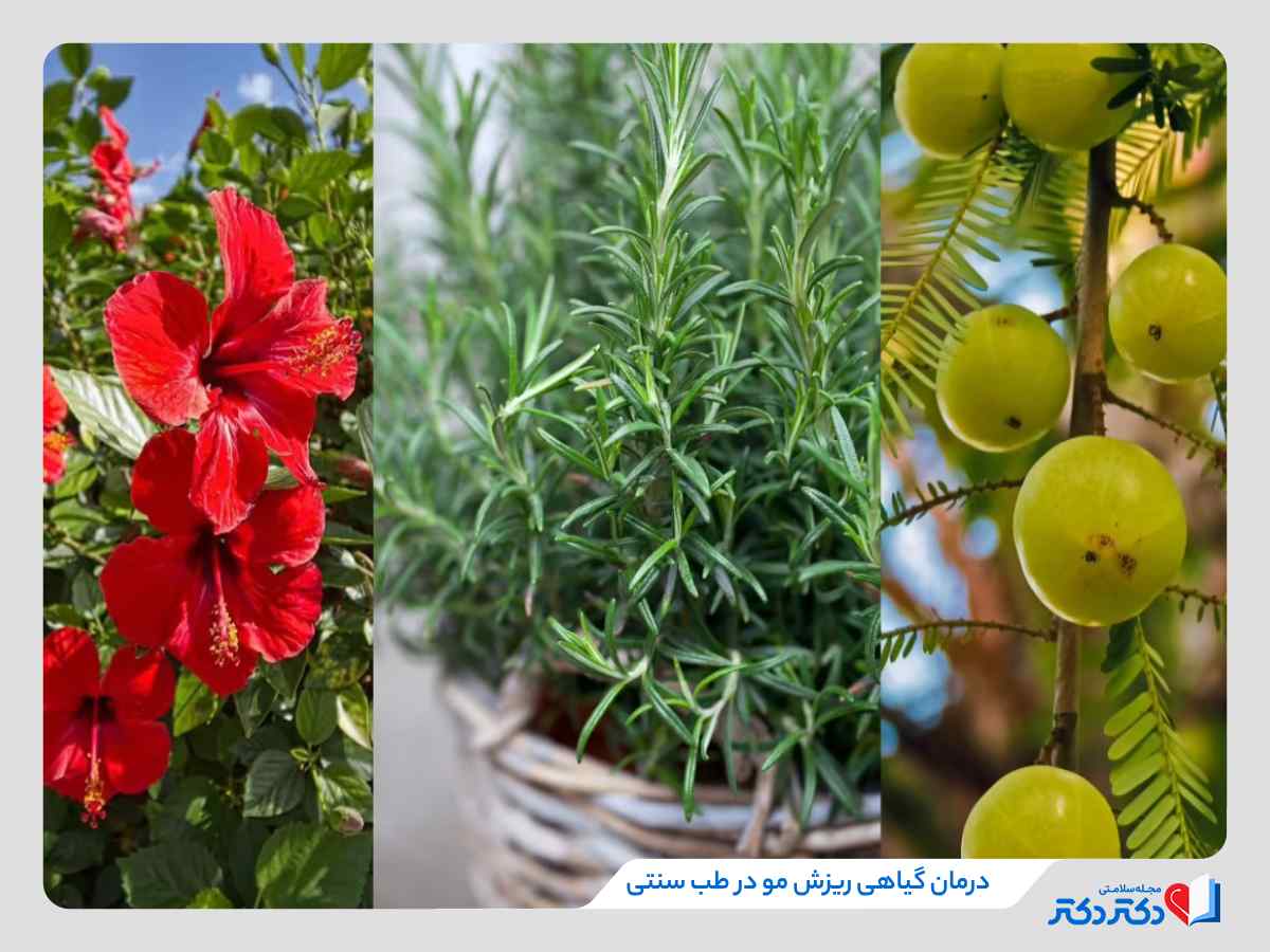 درمان ریزش مو در طب سنتی با گیاه