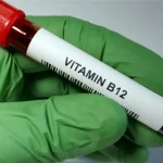 آزمایش ویتامین B12: از کاربرد تا تفسیر