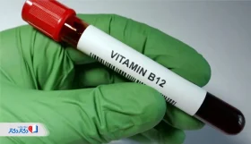 آزمایش ویتامین B12: از کاربرد تا تفسیر
