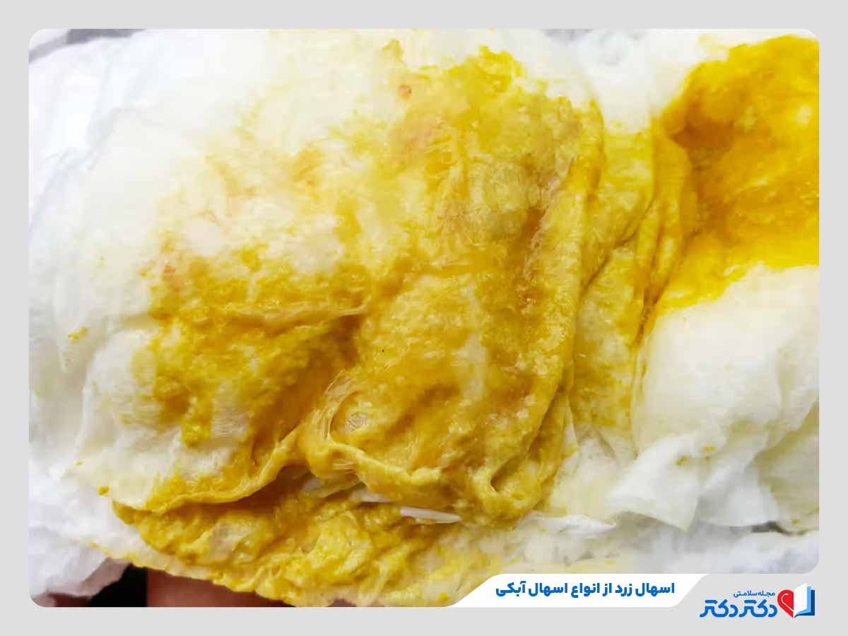 ابتلا به اسهال زرد از انواع اسهال آبکی
