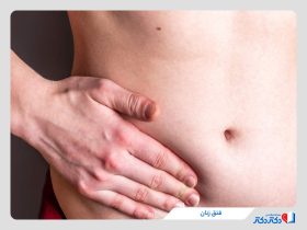 باد فتق زنان چیست و چه علائمی دارد؟