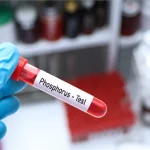 هرآنچه باید درباره آزمایش فسفر (phosphorus) بدانید!